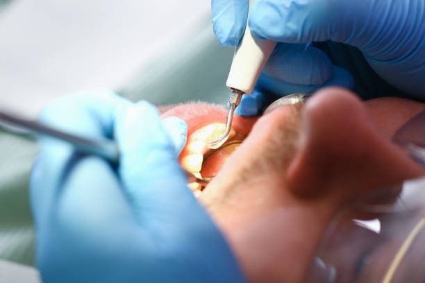 Best Same-Day Emergency Dentist in Loudoun Lley Estates, VA